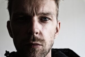 お尻の黒ずみ解消に効果的なクリームはどれ？